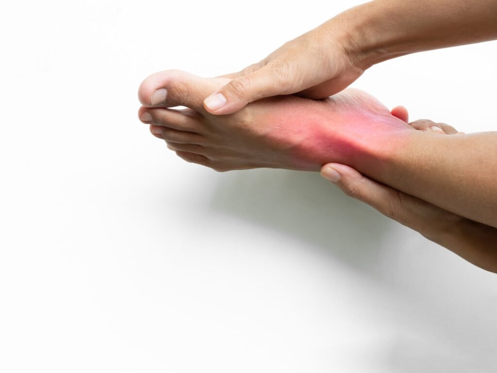 Sore ankle Pain Foot Woman, Sprain Feet Heel Knee Sore